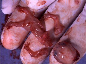 Dead Fetus Cells in Pepsi & other Products