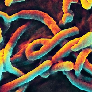 Ebola - Photo by NIAID