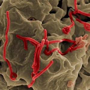 Ebola Virus - Photo by NIAID